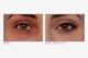 Bye Bye Under Eye™ Concealing Pot Medium Bye Bye Under Eye™ Concealing Pot Medium