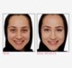Bye Bye Under Eye™ Concealing Pot Medium Bye Bye Under Eye™ Concealing Pot Medium